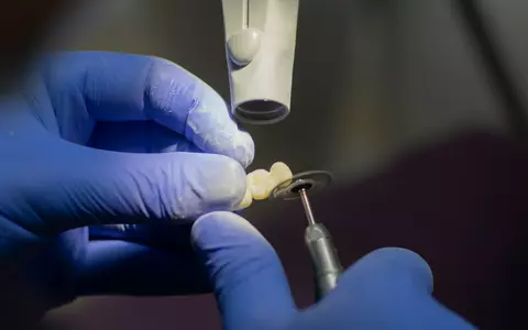 Tratamente dentare avansate: cum să alegi cea mai bună soluție pentru tine