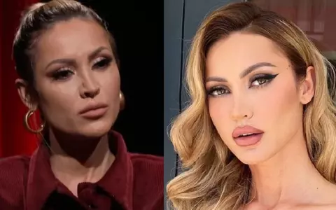 Nicoleta Dragne a avut complicații grave din cauza unei intervenții estetice: „A trebuit să mă operez de urgență. Mi-a spus că, dacă mai stăteam câteva zile, făceam septicemie”