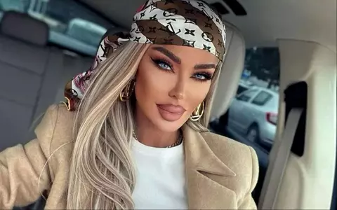 E campioană la intervențiile estetice, dar are un regret! Bianca Drăgușanu: "Să nu faceți asta niciodată la nimeni, niciunde. M-au mutilat!"