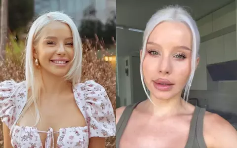 Carmen Grebenișan spune că a fost filmată de un bărbat și se teme că imaginile ar putea ajunge pe site-uri dubioase: „Telefonul lui stătea îndreptat spre mine”. Ce i-a răspuns bărbatul când l-a confruntat
