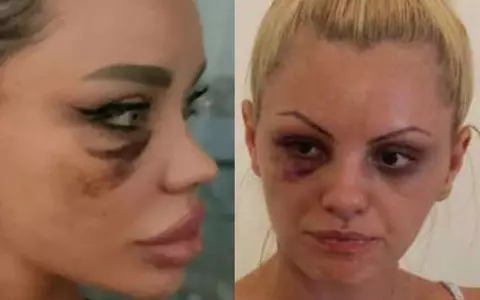 Vedete din România, victime ale violenței domestice. Bianca Drăgușanu, Alexandra Stan, Mirabela Dauer, și Dana Războiu, despre bătăi și umilințe care lasă traume pe viață