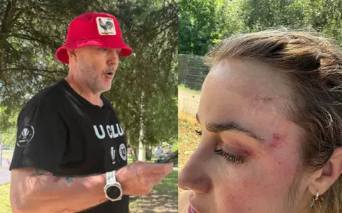 Un bărbat a bătut o femeie în parc de față cu fiica ei: "Să îți închizi gura, să pleci din parc și să nu mai apari acolo niciodată!". Totul a început de la un conflict între copiii lor