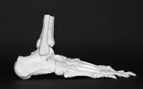 Cum alegi un medic ortoped bun – La ce să fii atent