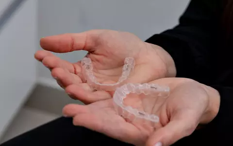 Implant dentar sau fațete dentare? Care este soluția optimă pentru restaurarea danturii