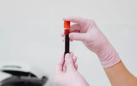 Mit vs. realitate: Cât de des ar trebui să îți faci analize medicale?