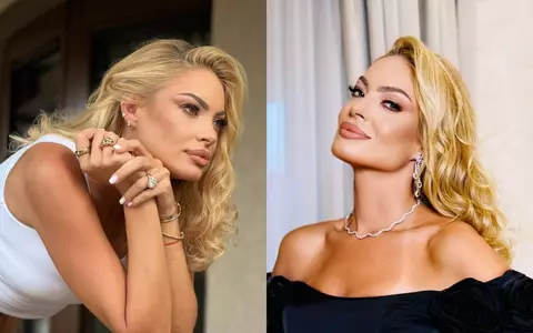 Valentina Pelinel recunoaște că apelează la intervenții estetice în mod regulat: "Ar fi culmea să spun că nu". Ce tratamente își face, la 44 de ani