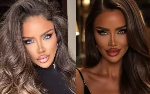 Bianca Drăgușanu și-a topit din nou acidul hialuronic din buze: "O să mă opresc la un moment dat și cu chestia asta". De ce a luat această decizie