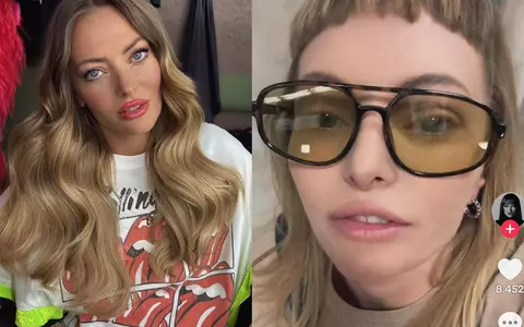 Cu ce problemă de sănătate se confruntă Delia de când avea 16 ani: „Și-a făcut cineva operație? Cât durează recuperarea?”