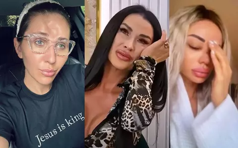 Vedete care au fost bătute de partenerii lor. Dana Războiu, Alexandra Stan, Mirabela Dauer, victimele unor abuzuri de neimaginat: „Dacă nu fugeam, mă omora”