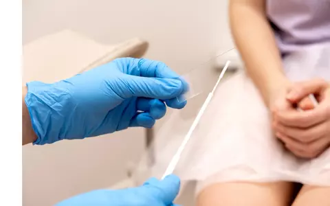 Candidoza vaginală: cauze, simptome și opțiuni de tratament