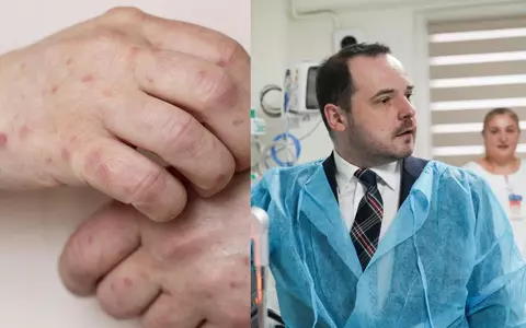 A fost confirmat al doilea caz de lepră la Cluj! De unde au luat boala femeile, de fapt. Ministrul Sănătății explică ce trebuie să știe clienții lor de la salon: „Se face anchetă epidemiologică extinsă”