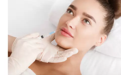 Acid în buze în București: detalii despre procedură, costuri și cum obții un look de invidiat