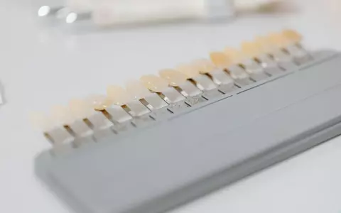 Cum pot soluțiile moderne din Angelescu Dental Clinic să ofere un zâmbet natural, sănătos și perfect funcțional