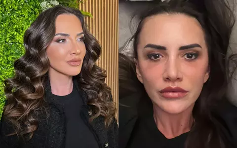 Mara Banică a răbufnit după ce a fost aspru criticată în urma liftingului facial: "Mi-am recăpătat strălucirea după cea mai grea perioadă din viața mea"