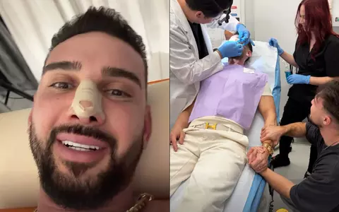 Cum arată Dorian Popa la 12 zile de la operația la nas. Și-a dat jos bandajele: „Cum nici nu am visat. O respirație impecabilă!”