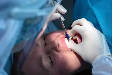Importanța coroanelor dentare în menținerea sănătății orale și estetice