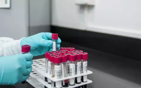 Bărbatul de 25 de ani din Arad, testat pozitiv, are hantavirus. Institutul Cantacuzino: "Tulpina e asociată șoarecilor, nu se transmite de la om la om"