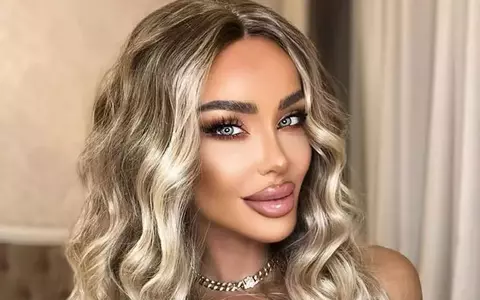 Bianca Drăgușanu își face a treia rinoplastie: "În loc să îmi facă un nas mai mic, mi-a făcut un nas mai mare"
