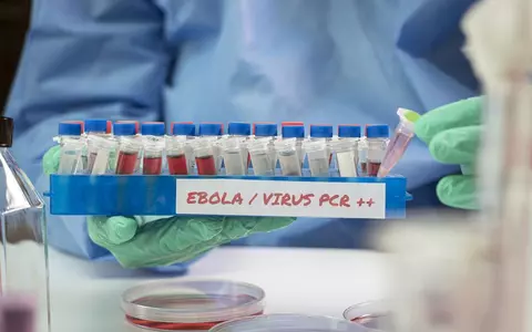 Ce este Ebola, cum se transmite, cât de mortal e virusul și ce tratamente există