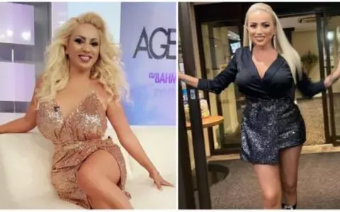 Rocsana Marcu, intervenție estetică de 8 ore la o clinică din Dubai: "Ceea ce a început ca o problemă medicală s-a încheiat cu cel mai bun rezultat posibil"