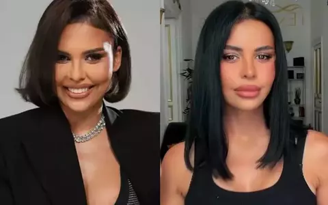Andreea Popescu a dezvăluit ce operații estetice și-a făcut: „Îți îmbunătățești anumite părți ale corpului” / De ce a luat decizia și ce efecte adverse a avut anestezia