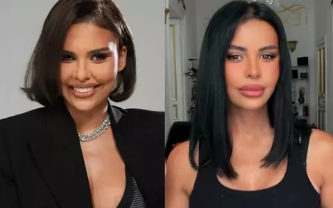 Cum arată Andreea Popescu la o săptămână de când și-a făcut intervenții estetice la față și la sâni: „Bine v-am regăsit”/ Cum au reacționat fanii când au văzut-o