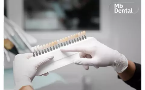 Cum pot tehnologiile disponibile la Mb Dental să reducă timpul petrecut la dentist