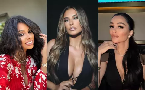 Tot ce trebuie să știi despre Aquafilling, procedura „minim invazivă”, considerată cel mai mare eșec al chirurgiei estetice. Antonia, Laurette și Brigitte Pastramă, printre vedetele care au avut de suferit