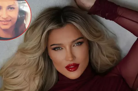 Cum arăta Lora înainte de intervențiile estetice. Artista a spus ce modificări și-a făcut la nivelul feței: „Nu am liftinguri făcute sau fire”