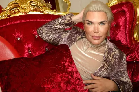 Adina Alberts, despre dezastrul Rodrigo Alves, aka Păpușa Umană Ken: ”Nici nu mai știm dacă e chip uman!”