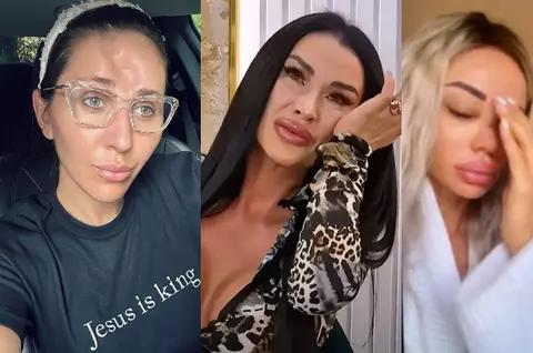 Vedete care au fost bătute de partenerii lor. Dana Războiu, Alexandra Stan, Mirabela Dauer, victimele unor abuzuri de neimaginat: „Dacă nu fugeam, mă omora”