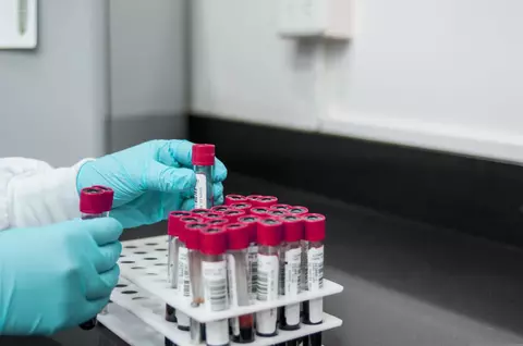 Bărbatul de 25 de ani din Arad, testat pozitiv, are hantavirus. Institutul Cantacuzino: "Tulpina e asociată șoarecilor, nu se transmite de la om la om"