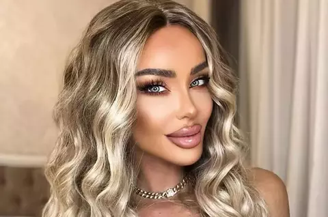 Bianca Drăgușanu își face a treia rinoplastie: "În loc să îmi facă un nas mai mic, mi-a făcut un nas mai mare"