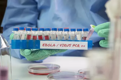 Ce este Ebola, cum se transmite, cât de mortal e virusul și ce tratamente există