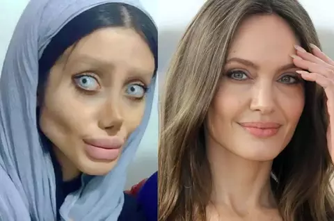 Ce s-a întâmplat cu Sahar Tabar, tânăra anorexică supranumită "Zombi Angelina Jolie", după ce a ieșit din închisoare: "Încă din copilărie mi-am dorit să fiu celebră, iar internetul mi s-a părut cea mai ușoară cale"