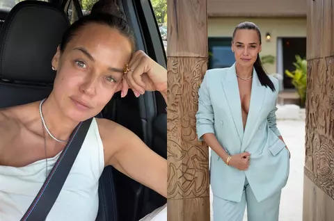 Andreea Raicu a început să își injecteze botox la 20 de ani, după ce o prietenă a convins-o: „Mi-am 'înghețat' fața total, ceea ce mi s-a părut îngrozitor. Dar așa făcea toată lumea în jurul meu”