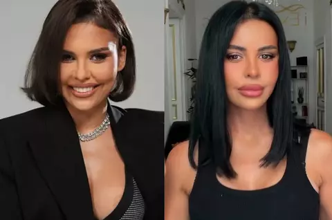 Cum arată Andreea Popescu la o săptămână de când și-a făcut intervenții estetice la față și la sâni: „Bine v-am regăsit”/ Cum au reacționat fanii când au văzut-o