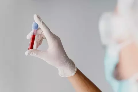 Creatinina serică: ce este și când este recomandată testarea sa