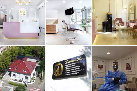 All-on-6 la Dental Chic Cluj-Napoca: cum se reface un zâmbet fix pe șase implanturi