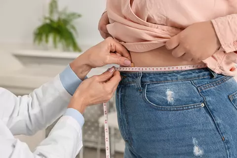 Obezitatea: cauze, simptome, diagnosticare și tratament