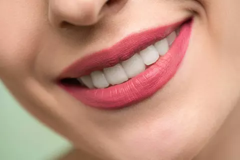 Estetică și funcționalitate dentară într-un singur loc – Angelescu Dental Clinic