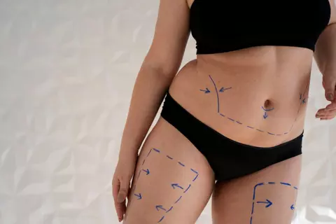 Remodelarea corporală în Suceava: cum arată un program personalizat și cu ce tehnologii se lucrează?