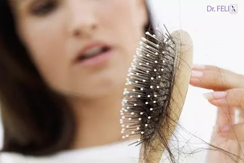 Alopecia la femei nu are o singură cauză: când să consideri un tratament la Dr. Felix Hair Implant
