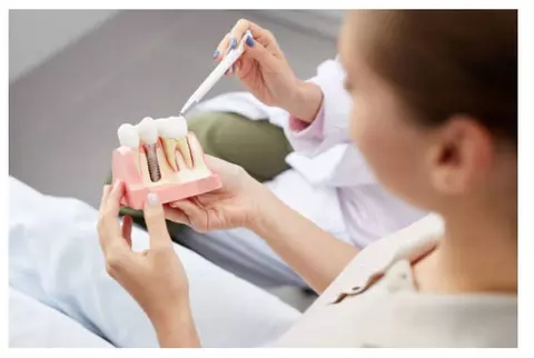 (P) Nu te teme de implantul dentar: mergi la o consultație la Smile Ambassador și scapă de frică!