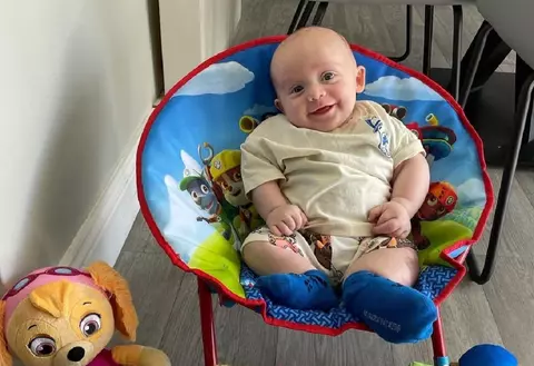 Un băiețel născut cu o afecțiune rară, din cauza căreia un picior îi "crește necontrolat", a făcut primii pași