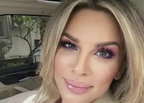 Ce intervenții estetice și-a făcut Alina Laufer și cum arăta înainte: „Mi-ar fi benefic”