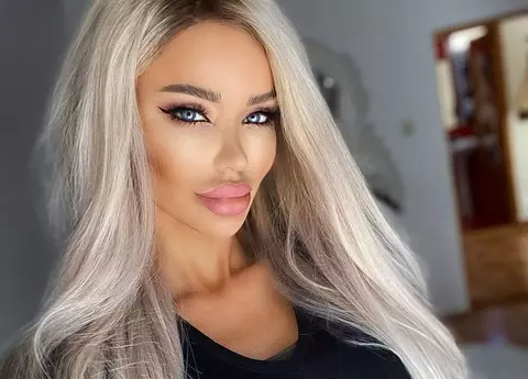 Bianca Drăgușanu și-a mărit, din nou, buzele. Cum arată acum: unii spun că îi stă bine, alții că a exagerat