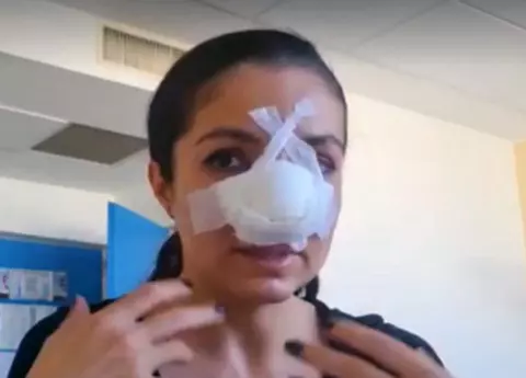 Cristina Joia, de la Visuri la Cheie, a făcut a doua operație la nas, după ce a fost bătută: „Intervenţia a durat cinci ore”