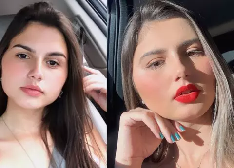 Caz unic în lume. Gemenii identici care și-au făcut simultan operație de schimbare de sex