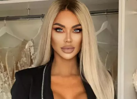 Bianca Drăgușanu își face o nouă intervenție estetică: „Mă voi opera până în momentul în care...”